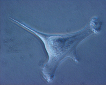 1) Cellula differenziata  (fibroblasto-ovino) appena trasfettata con il gene della protamina