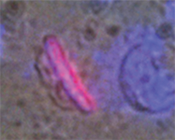 2) Dopo 48 ore, i fibroblasti che producono la protamina acquisiscono la struttura nucleare (in rosso) tipica dello spermatozoo